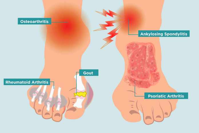 big toe joint pain