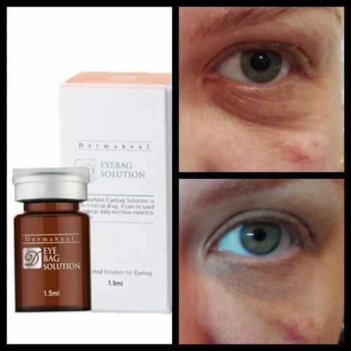 Dermaheal eyebag solution for the skin around the eyes